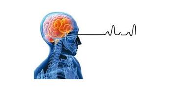 علائم ضربه مغزی | درمان و علایم آسیب مغزی